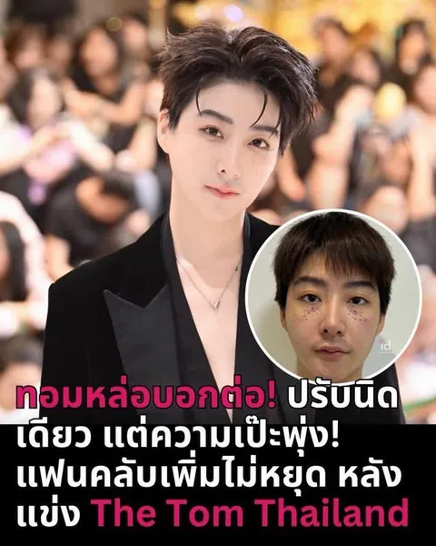 ID Hospital — จมูกผู้ชาย ที่ ID Hospital
