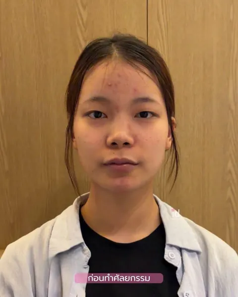 ID Hospital — สาวเวียดนามกับความเปลี่ยนแปลงที่ ID Hospital