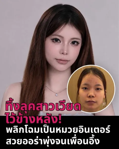 ID Hospital — สาวเวียดนามกับความเปลี่ยนแปลงที่ ID Hospital