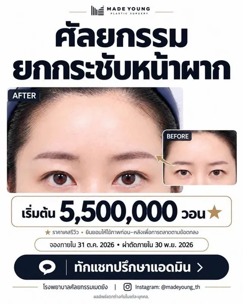Madeyoung Plastic Surgery — โปรโมชั่นเคสรีวิวเดือนตุลาคม 2026