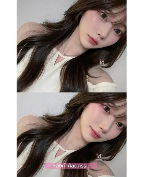 ID Hospital — จมูกผู้หญิง ที่ ID Hospital