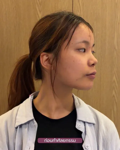 ID Hospital — สาวเวียดนามกับความเปลี่ยนแปลงที่ ID Hospital