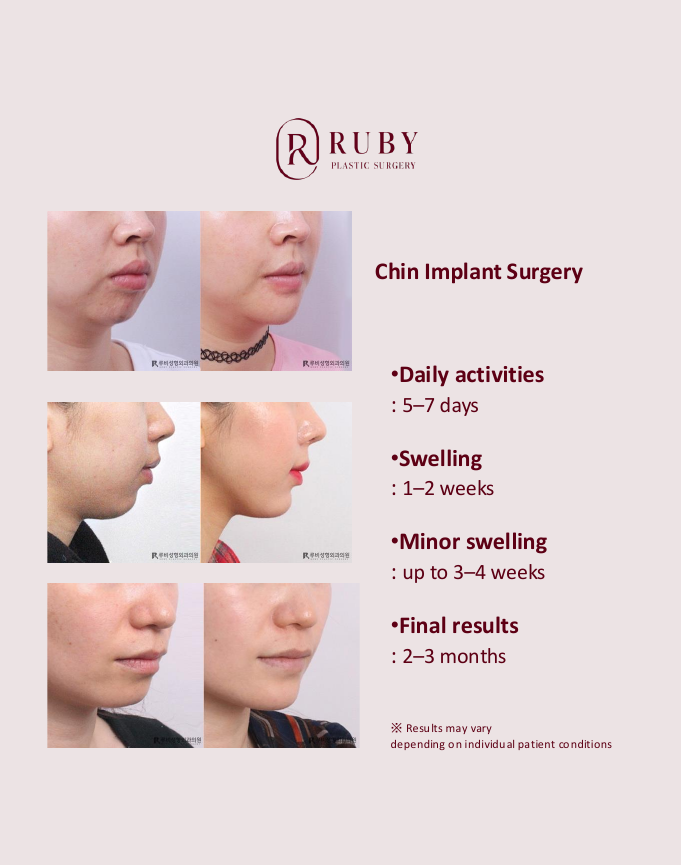 Chin-Correction.pdf — 3