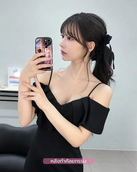 ID Hospital — จมูกผู้หญิง ที่ ID Hospital