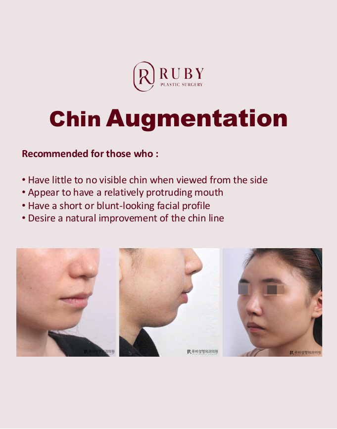 Chin-Correction.pdf — 2