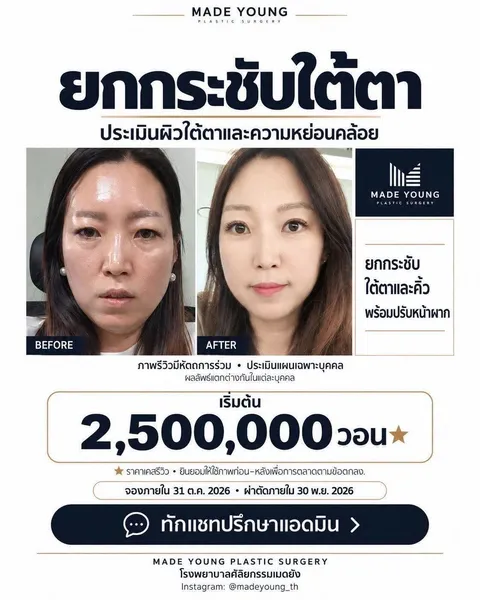 Madeyoung Plastic Surgery — โปรโมชั่นเคสรีวิวเดือนตุลาคม 2026